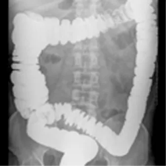 Diagnosi di stipsi secondaria – Cosa dire al paziente su procedure ed esami