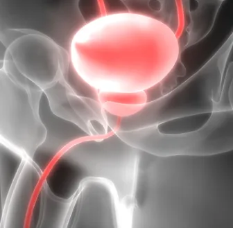 Cancro alla prostata, nuovo test per identificarlo. Ecco come funziona