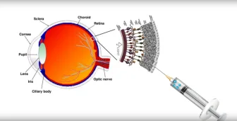 Novavido e R&D Alfasigma: progressi verso la retina artificiale liquida 