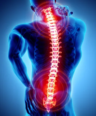 Neurostimolazione, una valida terapia per il male di schiena