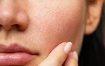 Quando la pelle è dolente: un sintomo da non trascurare